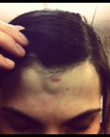 My First CrossFit Injury (Totally My Fault)
